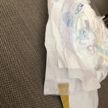 Bebek Bezinde Çift Taraflı Bant Tehlikesi