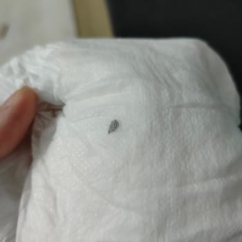 Bebek Bezinde Tehlikeli Yabancı Cisim