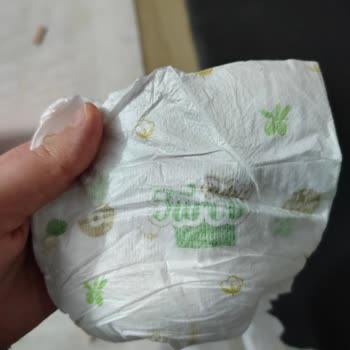 Bebek Bezinde Tehlikeli Yabancı Cisim