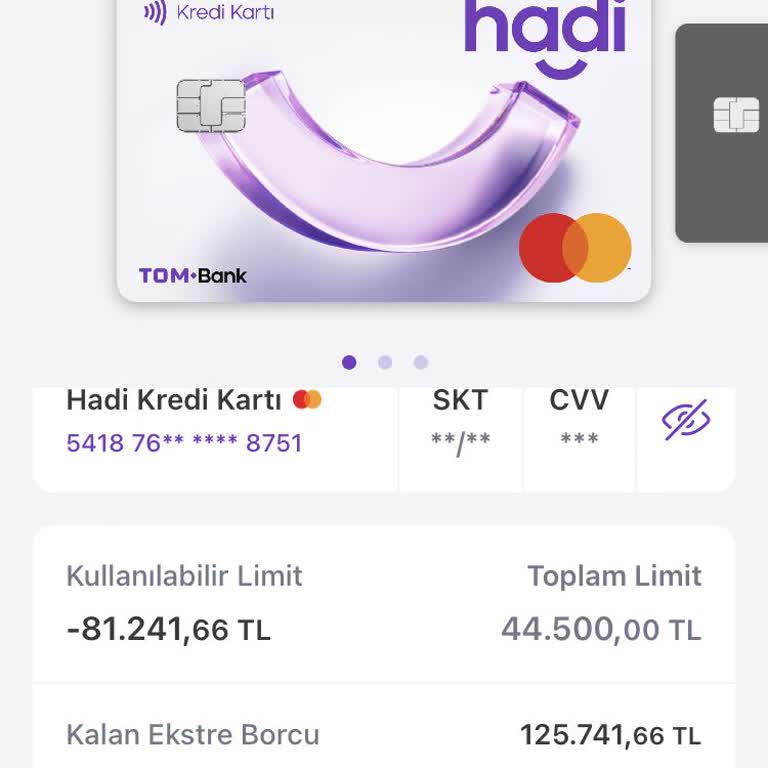Kredi Kartı Limit Sorunu Ve İletişim Eksikliği