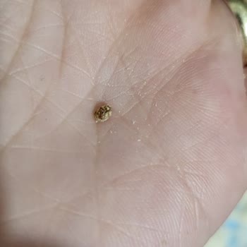 Hero Baby Mama İçerisinde Sert Cisim Bulunması