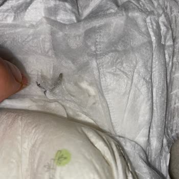 Sleepy Külot Bezinden Çıkan Böcek Şoku