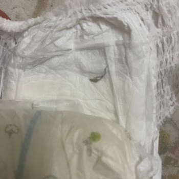 Sleepy Külot Bezinden Çıkan Böcek Şoku