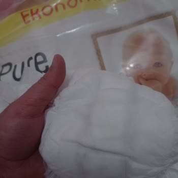 Pure Baby Bezlerde Üretim Hatası Mı Var?