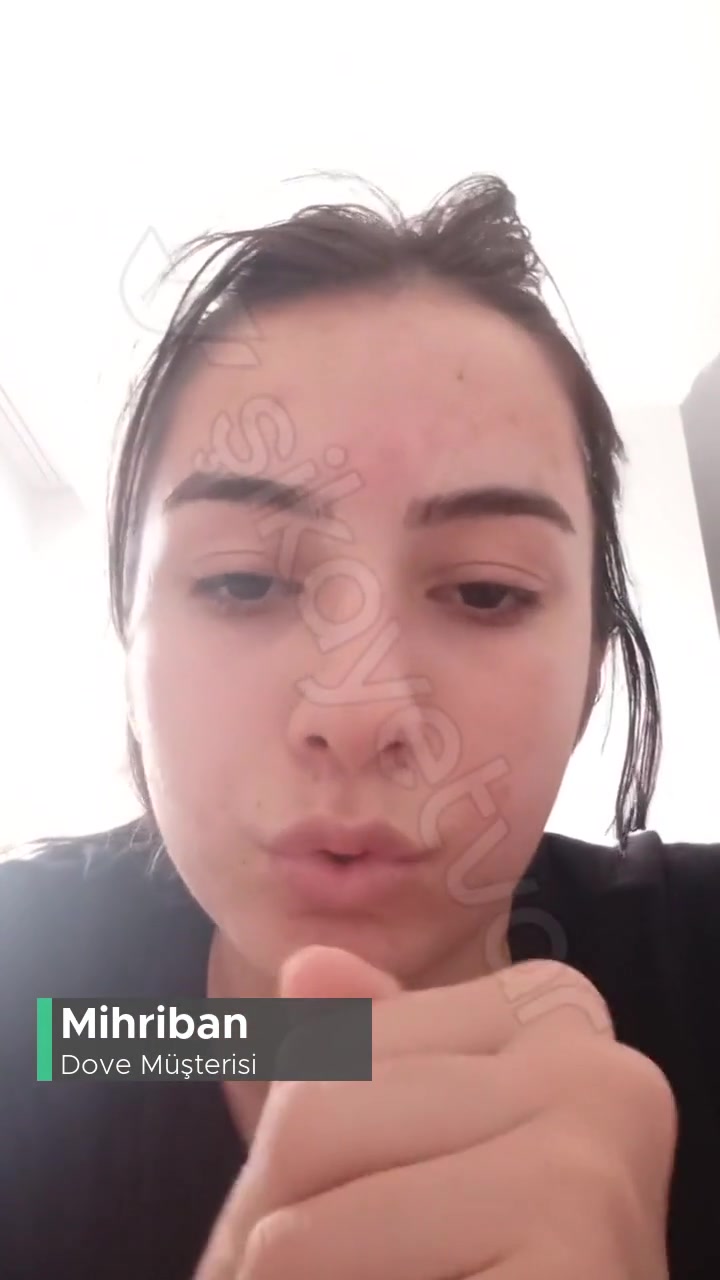 Dove Yüzümü Mahvetti! videonun kapak resmi