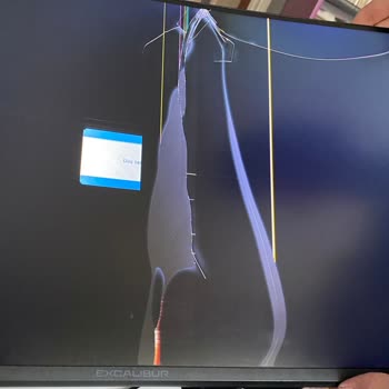 Trendyol'dan Alınan Monitörde Hasar Ve İade Sorunu