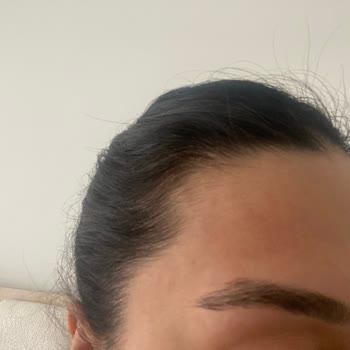 Kaş Hizmetinde Hayal Kırıklığı