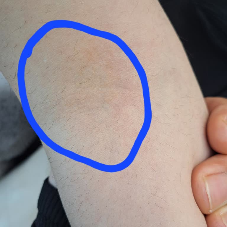 Vatan'dan Kent Meydanına Giden Otobüs Şikayeti