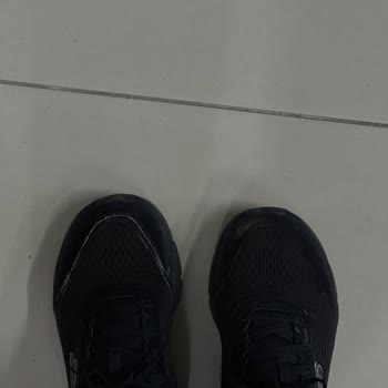 Skechers Ayakkabıda Tek Taraflı Beyazlama Sorunu