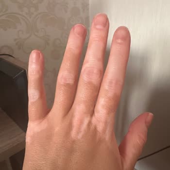 Sağlık Riski Taşıyan Yanıltıcı Hizmet