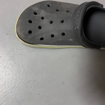 Crocs Terlikte Beklenmedik Açılma Ve Garanti Sorunu