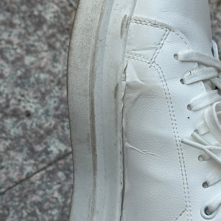 Trendyol Ve Pull And Bear Arasında Kayıp Ayakkabı İadesi