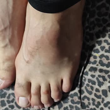 Cemil Taşçıoğlu Şehir Hastanesi Acil Serviste İlgisizlik Ve Yetersiz Tedavi