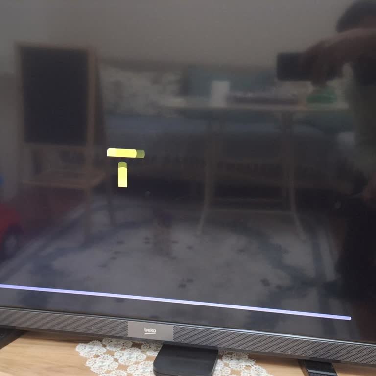 Tod TV Bağlantı Sorunu Ve Müşteri Hizmetleri Erişimsizliği