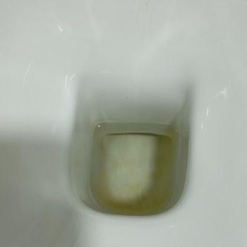 Yeni Aldığım Klozetin Temizlik Sorunları