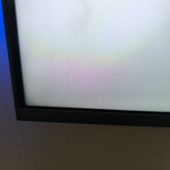 Yanlış Kurulum Ve Yetersiz Servis: Philips TV Mağduriyeti