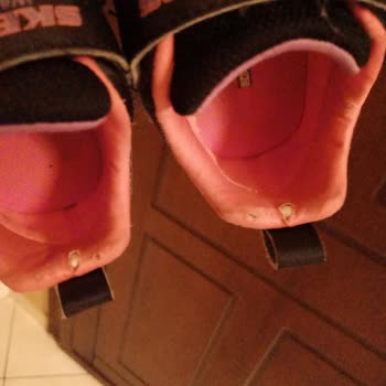 Skechers Ayakkabılarında Tekrarlayan Yırtılma Sorunu