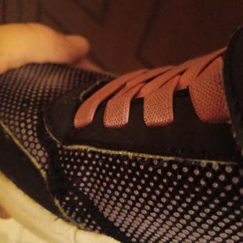 Skechers Ayakkabılarında Tekrarlayan Yırtılma Sorunu