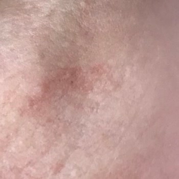 AVM'de Güvenlik Zafiyeti: İzmarit Tehlikesi