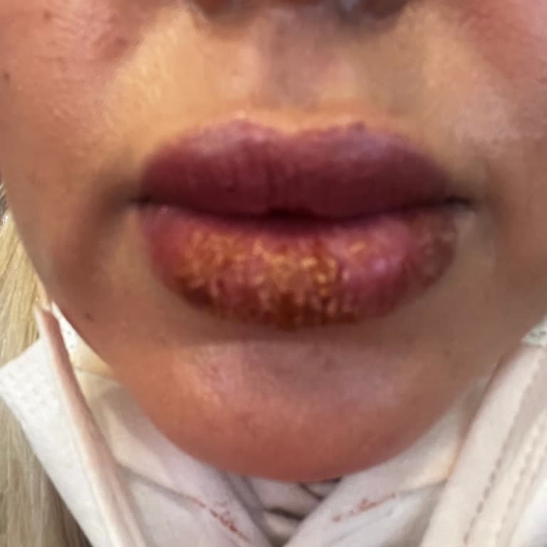 Sıloşcha Studio Hijyenik Olmayan Ve İnsanların Sağlığıyla Oynayan Bu İşletmeden Şikayetçiyim