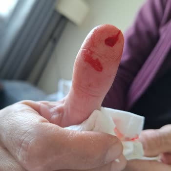 Tehlikeli Tencere Seti Ve İlgisiz Müşteri Hizmetleri