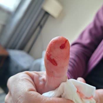 Tehlikeli Tencere Seti Ve İlgisiz Müşteri Hizmetleri