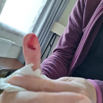 Tehlikeli Tencere Seti Ve İlgisiz Müşteri Hizmetleri