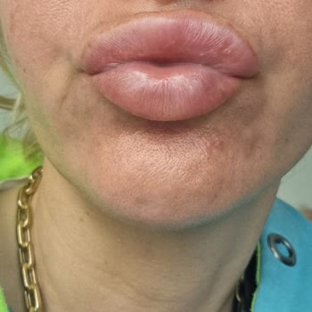 İstanbul'daki Hizmetin Hayal Kırıklığı