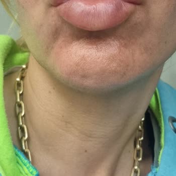 İstanbul'daki Hizmetin Hayal Kırıklığı