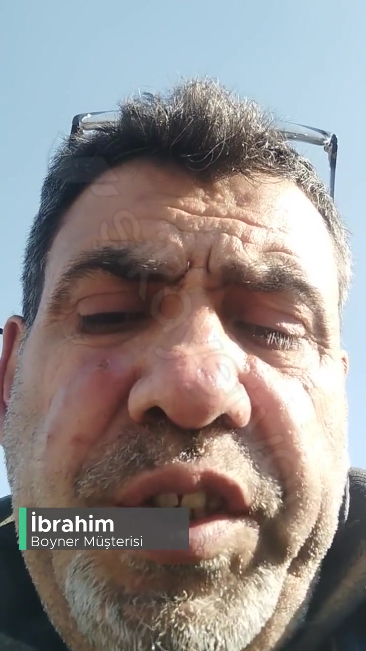 Boyner Defolu Ürün Değişimi! videonun kapak resmi
