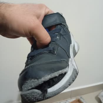 Skechers Kinder-Schuhe bekommen Risse und verursachen Fußwunden nach kurzer Nutzung