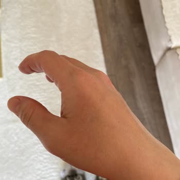 Mustela Ürünü Çocuğumda Alerji Yaptı