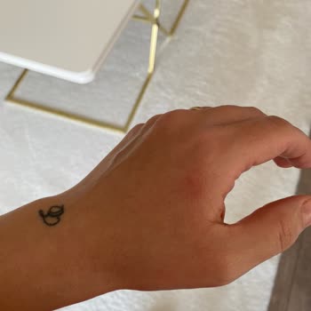 Mustela Ürünü Çocuğumda Alerji Yaptı