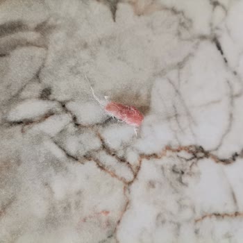 Pişmaniyede Hijyen Sorunu