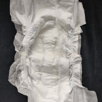 Molfix Bebek Bezlerinde Üretim Hatası