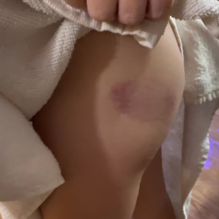 Otel Rezervasyonum Kabusa Döndü: Kötü Hizmet Ve İlgisizlik