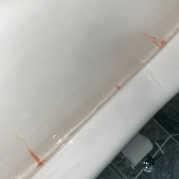 Kale Klozette Gizemli Kırmızı Leke Sorunu!