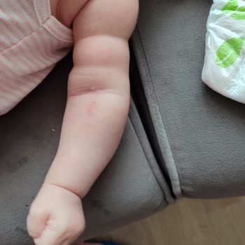 Sağlık Bakanlığı Hastanede İhmal Ve Bilgi Eksikliği: Küçük Bebeğin Zor Anları