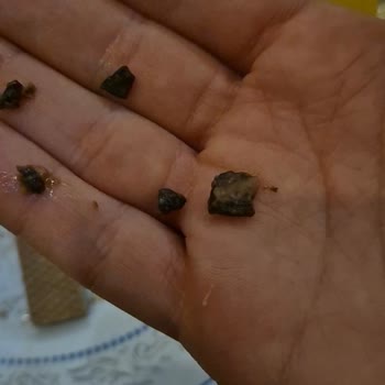 Torku Gofret İçinden Plastik Çıkması Skandalı