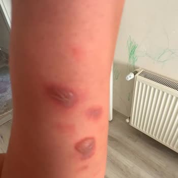 Mersin Pozcu Şubesi'nde Sağlık Sorunu Ve İlgisizlik