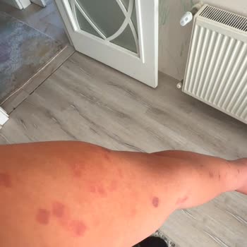 Mersin Pozcu Şubesi'nde Sağlık Sorunu Ve İlgisizlik