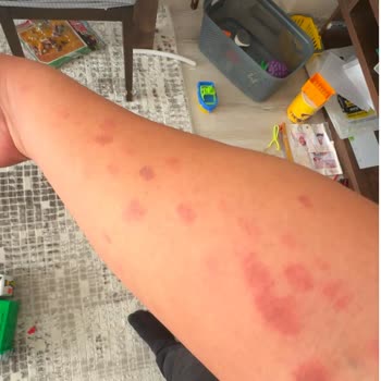 Mersin Pozcu Şubesi'nde Sağlık Sorunu Ve İlgisizlik