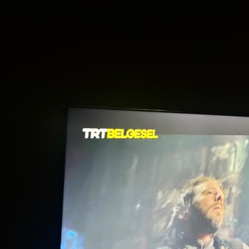 Grundig TV Tamirinde Işık Sızması Ve Kusurlu Hizmet