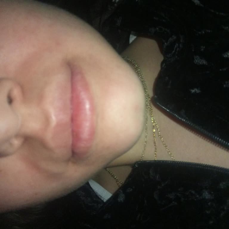 Effaclar Krem Yüzümü Yaktı, Ne Yapmalıyım?