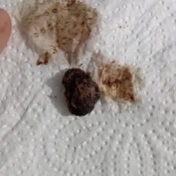 Kellogg's Coco Pops'ta Beklenmedik Sert Cisim