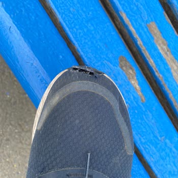 Adidas Ayakkabının Kalite Sorunu Ve Olumsuz İnceleme Deneyimi