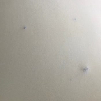 Kusurlu Yataklar Ve İade Talebi