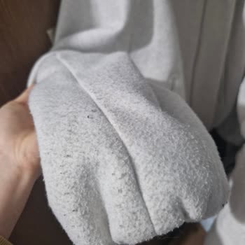 Zara Bomber Jacket Pilled After 5 Wears – Unacceptable Quality