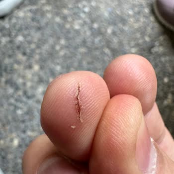 Paşabahçe Çay Bardağı Üretim Hatasıyla Elimi Kesti