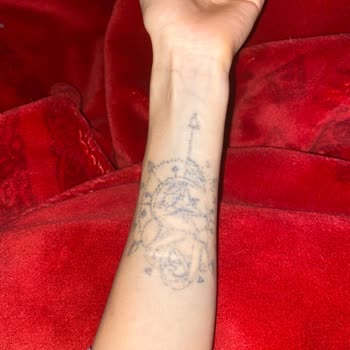 Yarım Kalan Dövme Silme İşlemi Ve Mağduriyet